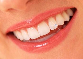 Ultra Sorriso Clínica Odontológica - Serviços Estéticos - Piercing Dental